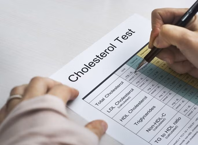 Bạn có bị cholesterok cao?. Ảnh: Shutterstock