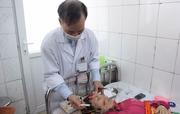 BS Tâm thuỷ châm và điện châm cho bệnh nhân bị liệt dân thần kinh số 7