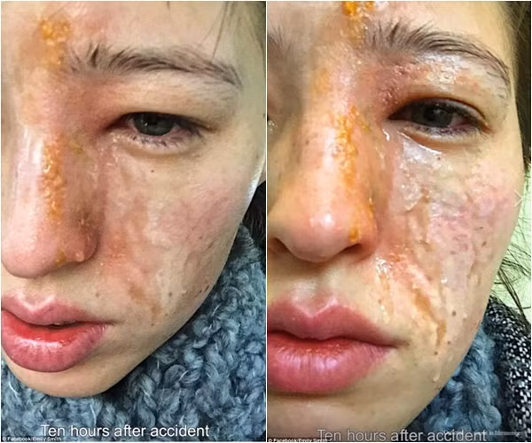 Tình hình tồi tệ hơn sau 10 tiếng.