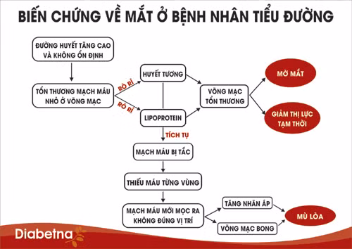 Tổn thương đáy mắt (võng mạc) có thể khiến người tiểu đường bị mù lòa. Tổn thương đáy mắt (võng mạc) có thể khiến người tiểu đường bị mù lòa.