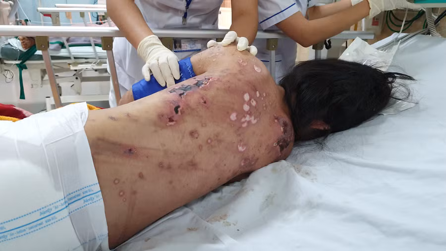 Thương tích trên người chị T. do các bị cáo gây ra - ẢNH: LÊ LÂM Thương tích trên người chị T. do các bị cáo gây ra - ẢNH: LÊ LÂM