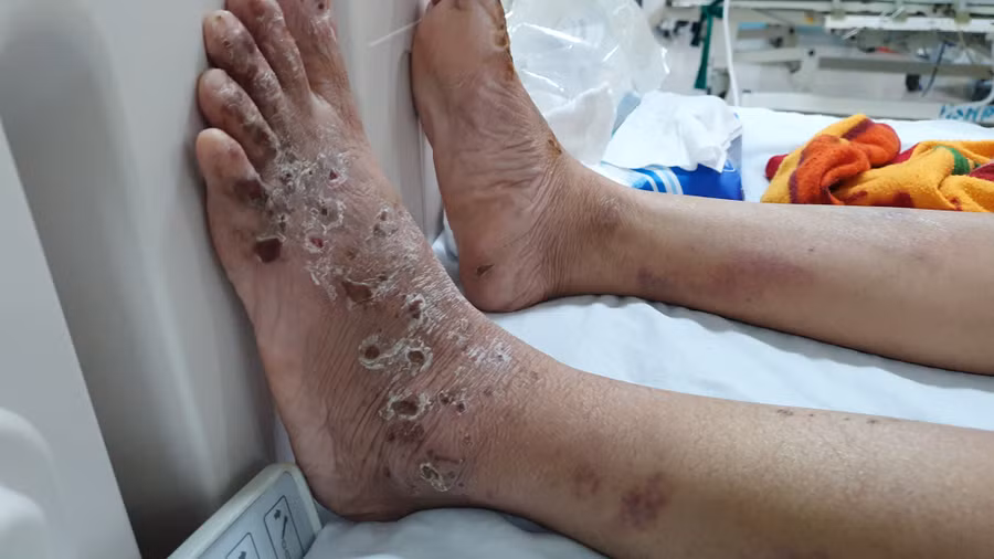 Kết quả giám định, chị T. bị tỷ lệ thương tích 96% - ẢNH: LÊ LÂM Kết quả giám định, chị T. bị tỷ lệ thương tích 96% - ẢNH: LÊ LÂM