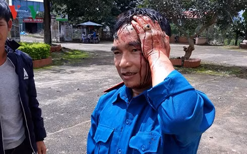 Ông Nguyễn Văn Thuận bị chém rách đầu, đổ máu. Ông Nguyễn Văn Thuận bị chém rách đầu, đổ máu.