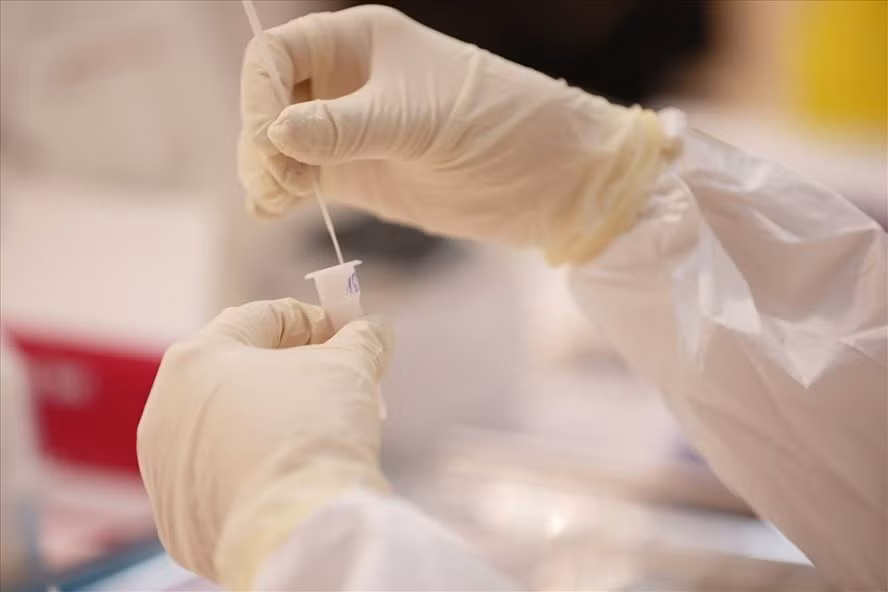 Xét nghiệm SARS-CoV-2. Ảnh: Hải Nguyễn