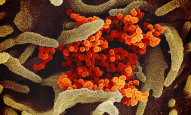 Ảnh chụp virus Corona bằng kính hiển vi electron. Ảnh chụp virus Corona bằng kính hiển vi electron.