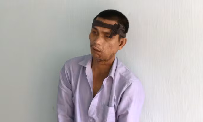 Đối tượng Nguyễn Văn Tùng sau khi bị bắt giữ