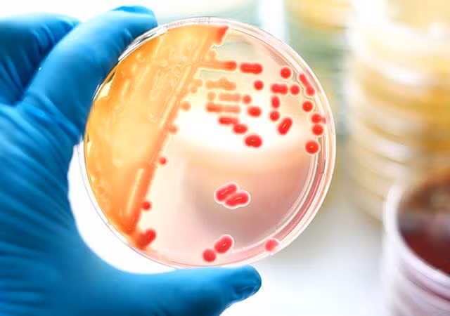  Tiểu Triệu bị nhiễm loại vi khuẩn kỵ khí Fusobacterium necrophorum