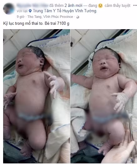 Hình ảnh bé sơ sinh nặng 7,1kg được đăng tải lên mạng xã hội.