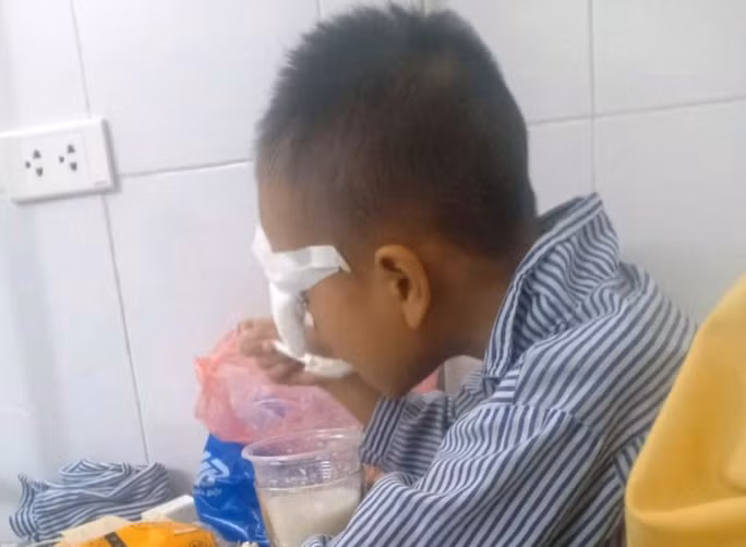 Nam sinh lớp 1 bất ngờ bị tổn thương nặng ở mắt đang được điều trị tại bệnh viện