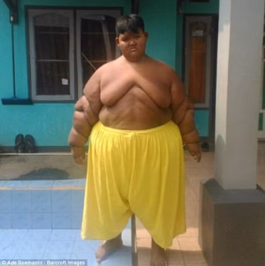 Arya Permana nặng 190 kg. Ảnh: Barcroft Images Arya Permana nặng 190 kg. Ảnh: Barcroft Images