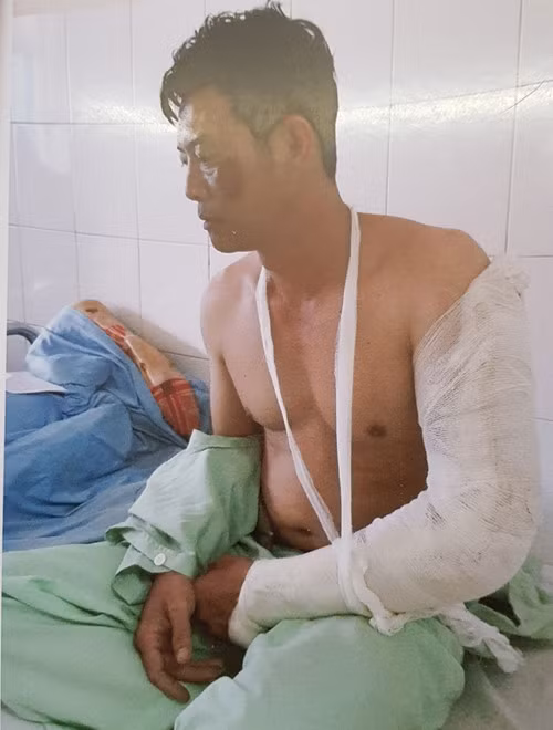 Ông Hậu bị chém gần đứt lìa cánh tay, thương tích 43%. Ông Hậu bị chém gần đứt lìa cánh tay, thương tích 43%.