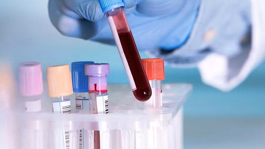 Xét nghiệm máu mới phát hiện ung thư di căn chính xác đến 94%. Ảnh: Shuterstock