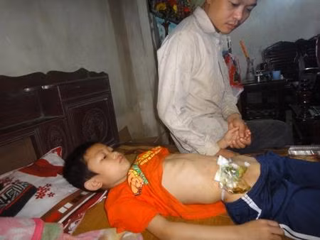 Mang căn bệnh hiểm nghèo, Phát lại thiếu hơi ấm của người mẹ nên đã 10 tuổi nhưng thân hình của cháu như đứa trẻ lên 5, bị gầy gò ốm yếu, chỉ nặng chưa đầy 19kg.