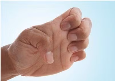 Bài tập móng vuốt.
