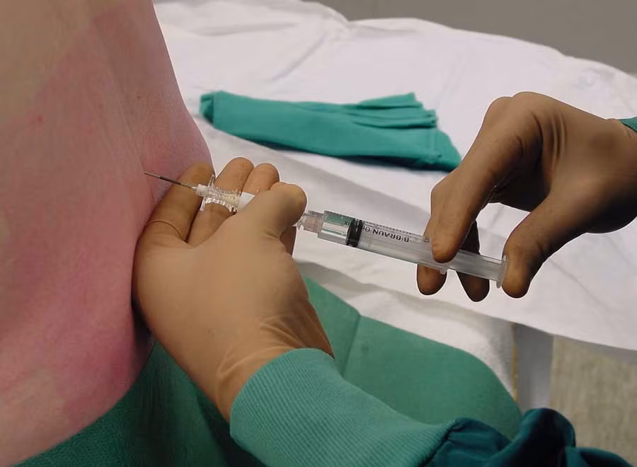  Phương pháp gây tê tủy sống trước khi mổ. 