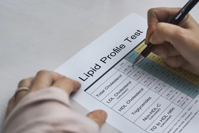 Một trong những cách tốt nhất để giữ mức cholesterol trong tầm kiểm soát là theo một chế độ ăn uống cân bằng ẢNH MINH HỌA: SHUTTERSTOCK