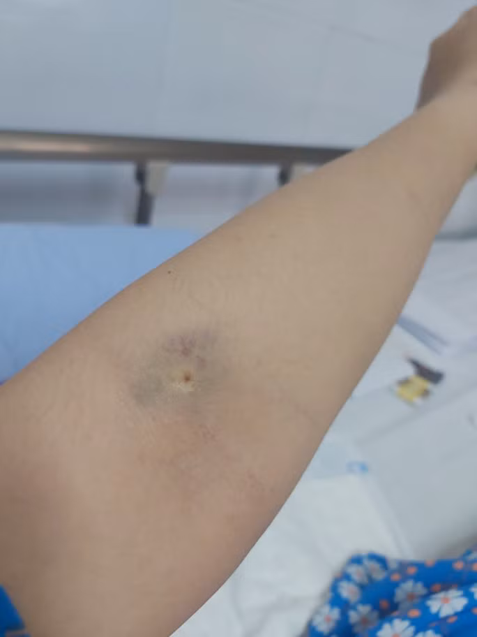 Chị T. bức xúc đưa hình ảnh bị ảnh hưởng khi điều trị lên mạng cá nhân