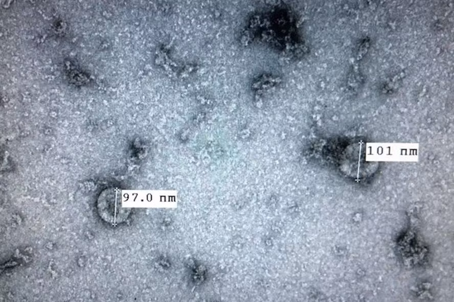 Chủng virus SARS-CoV-2 mà Việt Nam đã phân lập được trước đó. Ảnh: Viện VSDT TƯ