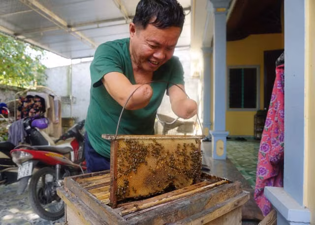 Mất đôi tay, ông 